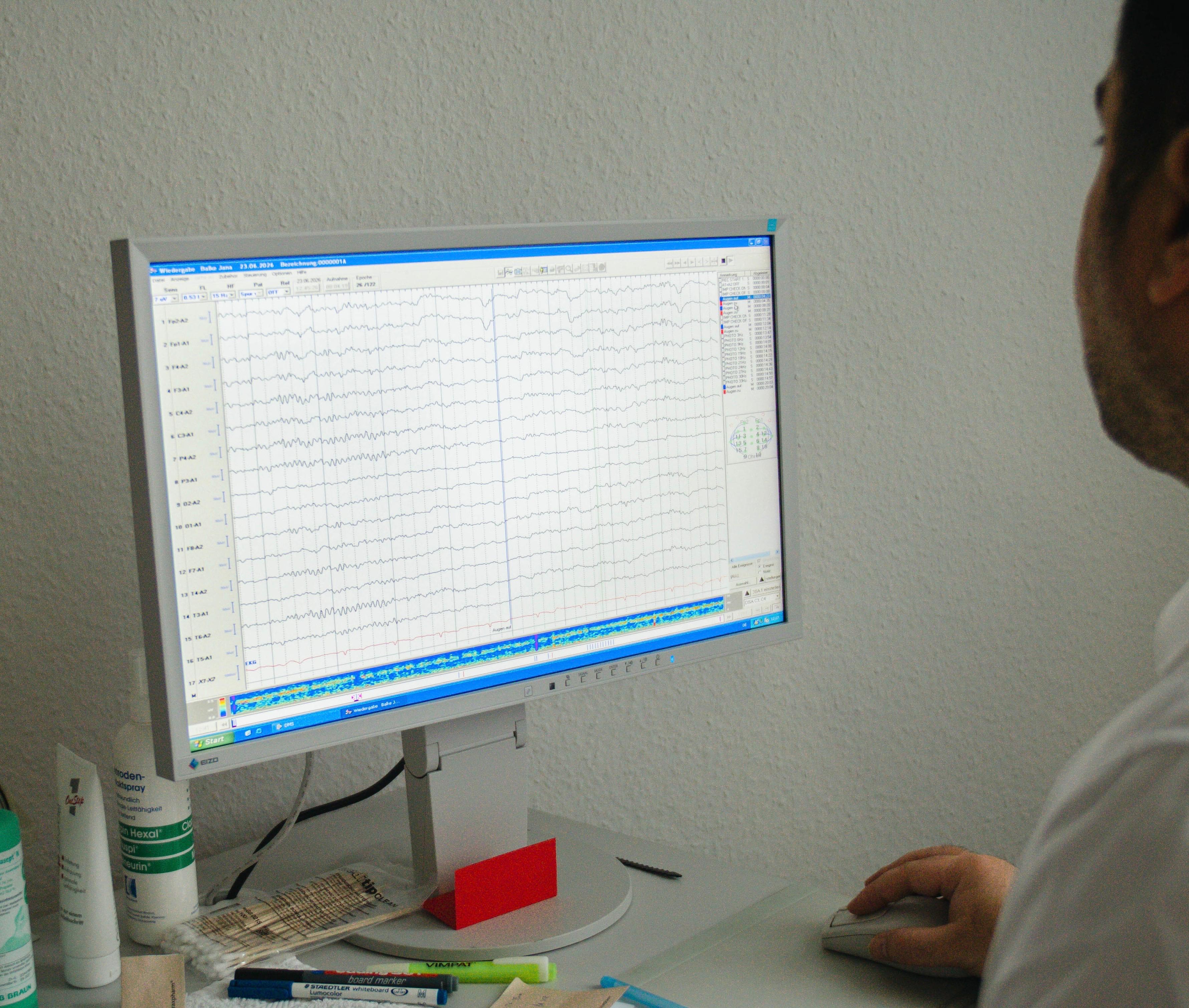 Elektroenzephalographie (EEG)